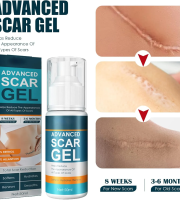 অ্যাডভান্স স্কার জেল -দাগ দূর করার ম্যাজিক জেল